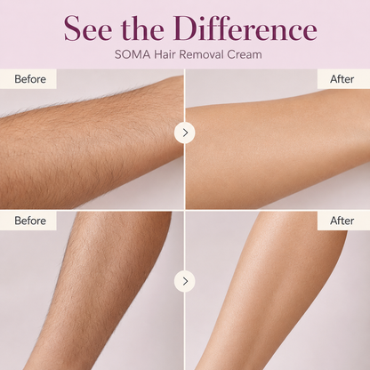 Soma Hair Removal Cream 100g
