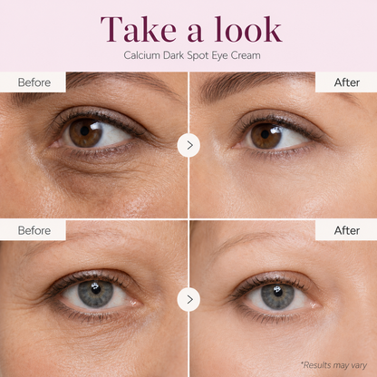 SOMA Calcium Bright Eye Cream 15mg